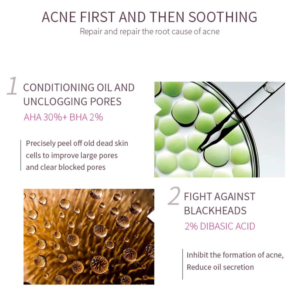AHA 30% + BHA 2% peeling solution close-up highlights pore refinement potential