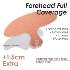 Akissos forehead coverage extending to 11 lines for comprehensive lift