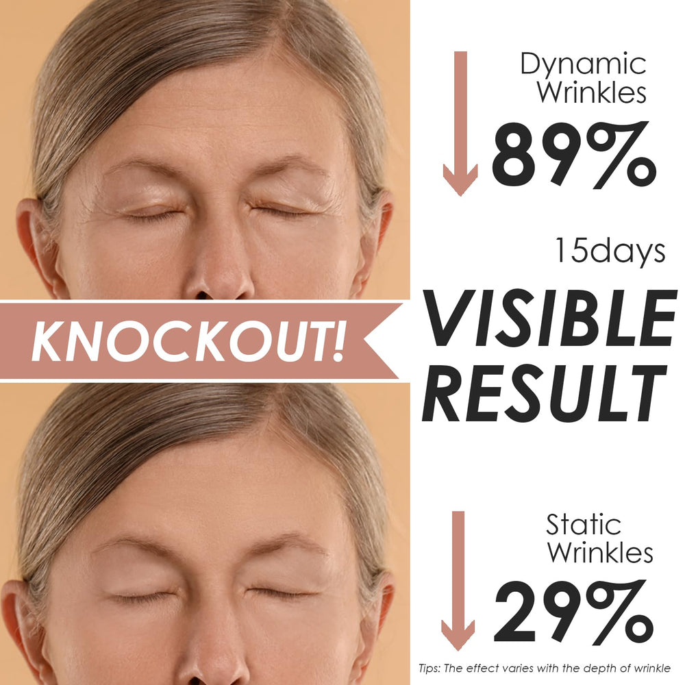 Akissos overnight face tape adheres securely without slipping