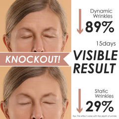 Akissos overnight face tape adheres securely without slipping