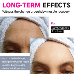 Overnight use scene with Akissos wrinkle patches on the forehead