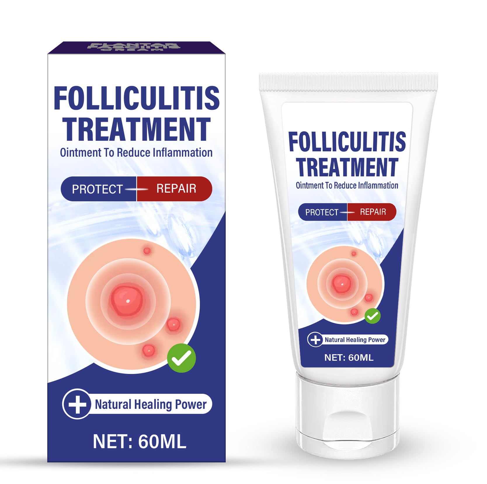 AKQBPN Folliculitis Cream in a tube provides gentle relief on skin.