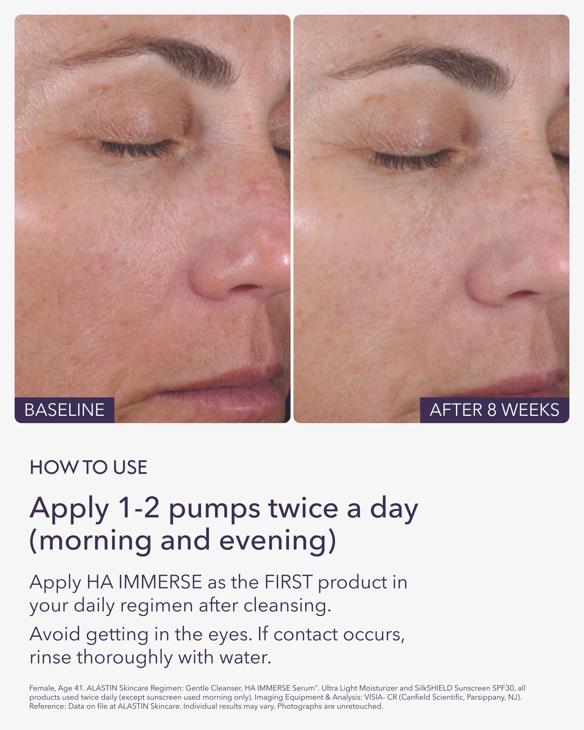 Texture close-up of ALASTIN Hyaluronic Acid IMMERSE Serum
