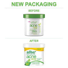Alba Botanica AcneDote pads with witch hazel and thyme for refreshing cleanse.