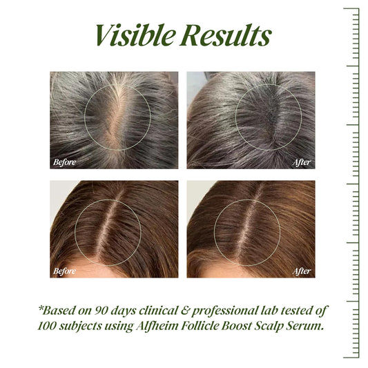 ALFHEIM scalp serum applicator for precise root drops.
