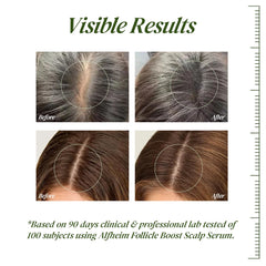 ALFHEIM scalp serum applicator for precise root drops.