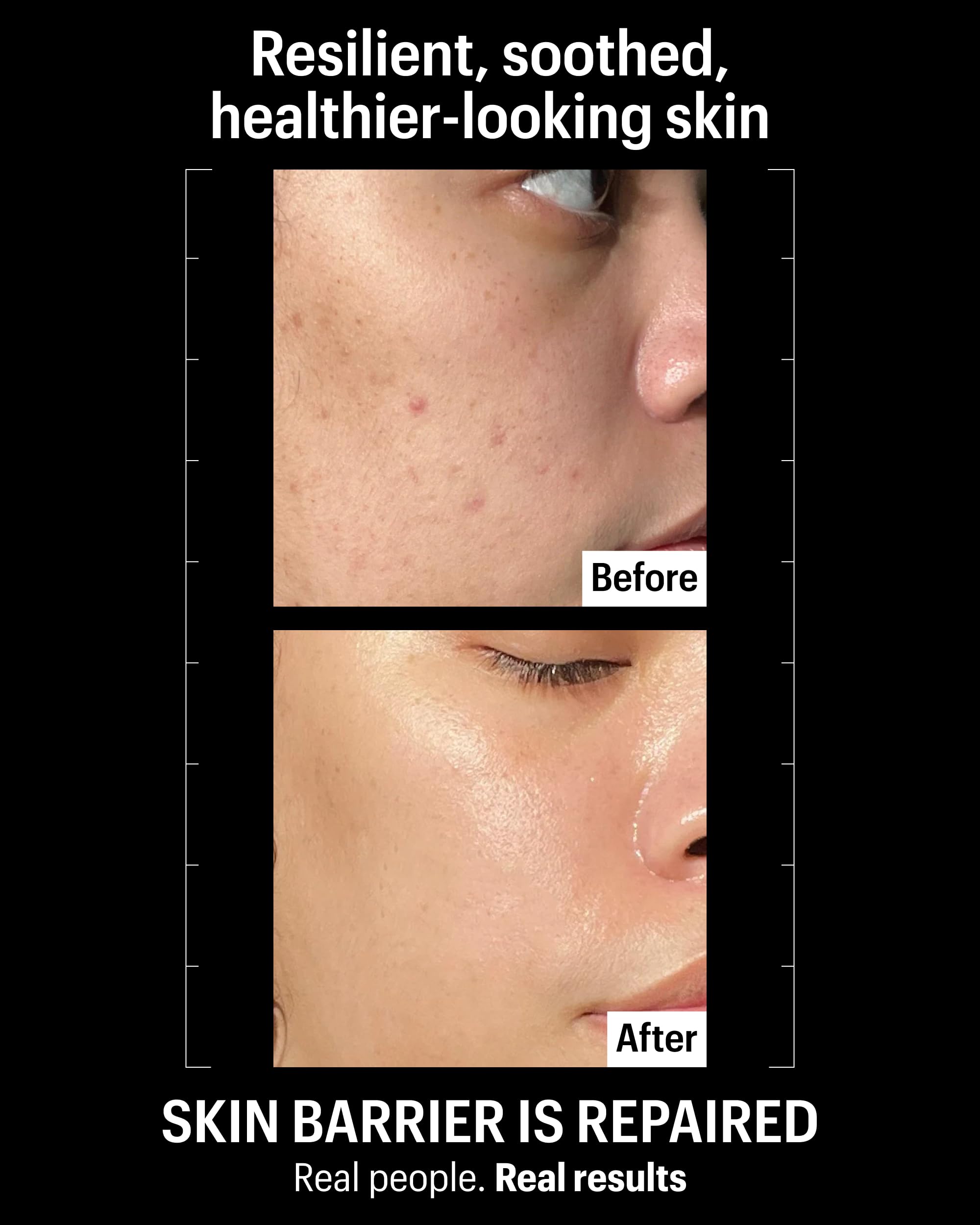 Allies of Skin Molecular Barrier Repair Cream Balm being applied to the face for nourishment