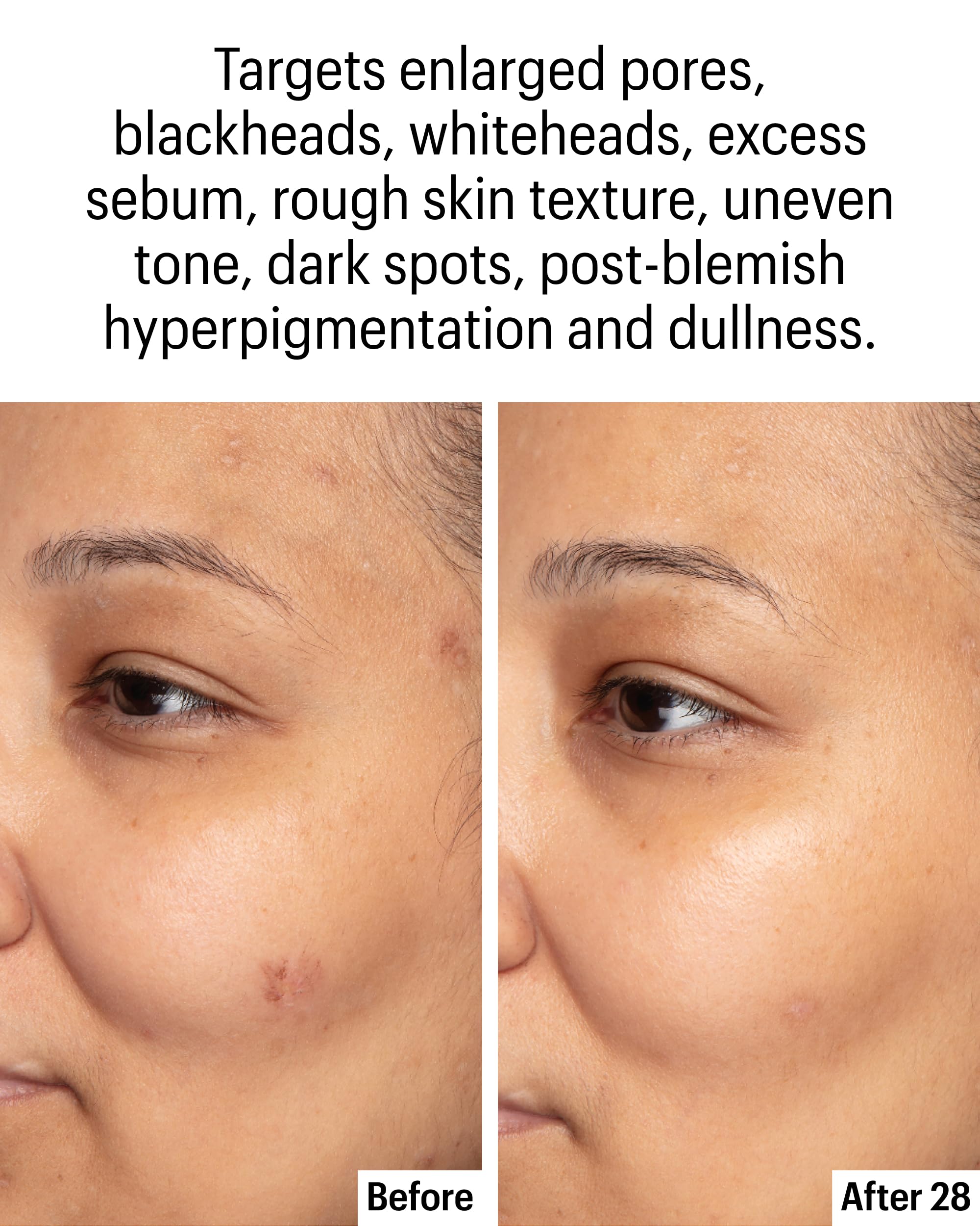 Allies of Skin close-up showing smoother texture and reduced redness.