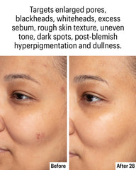 Allies of Skin close-up showing smoother texture and reduced redness.