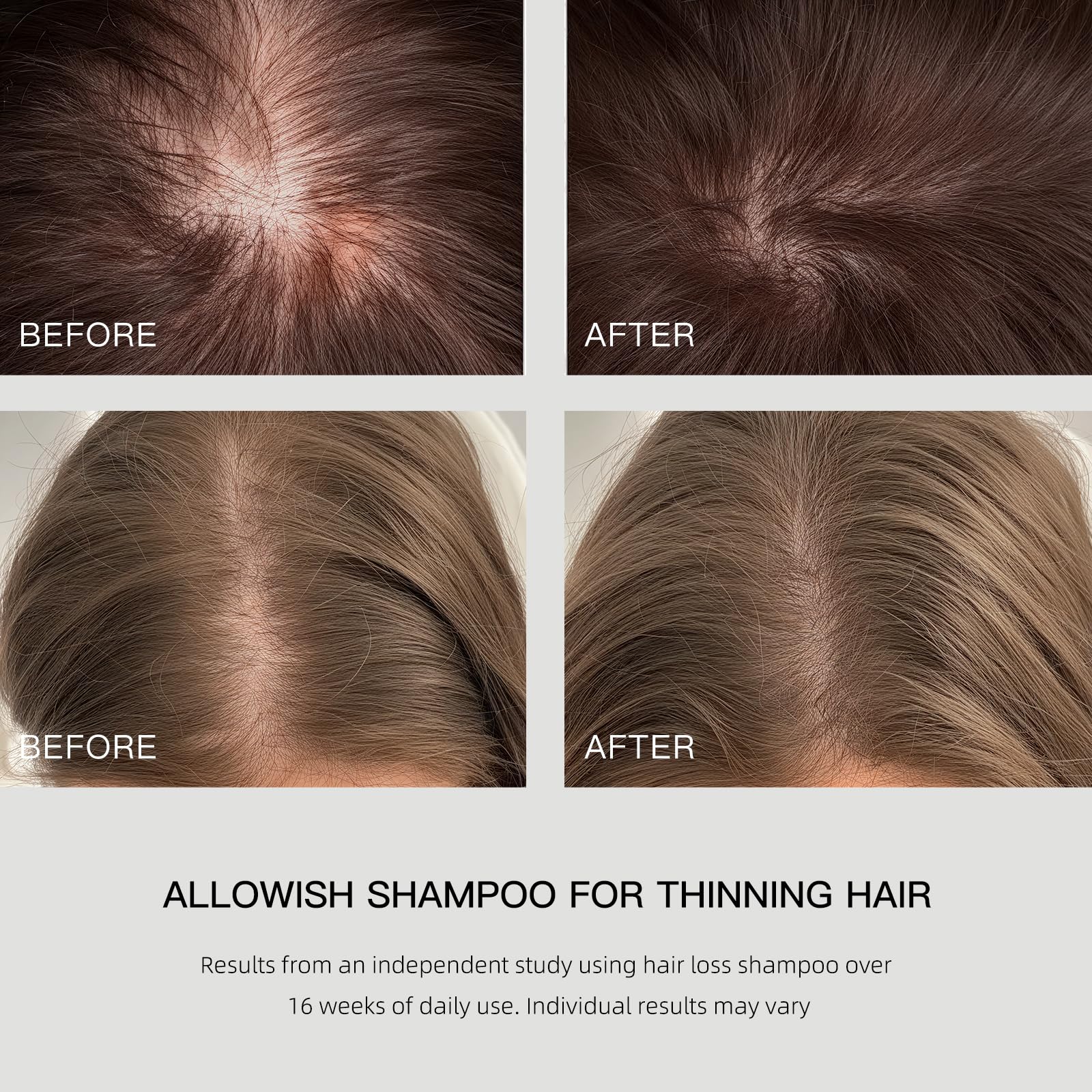 ALLOWISH rosemary oil ingredient close-up hints natural scalp support