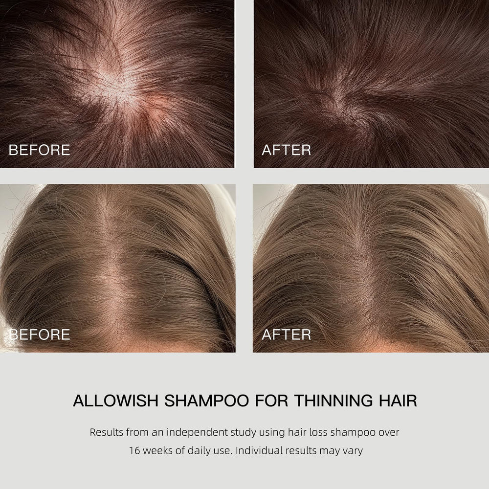 ALLOWISH rosemary oil ingredient close-up hints natural scalp support