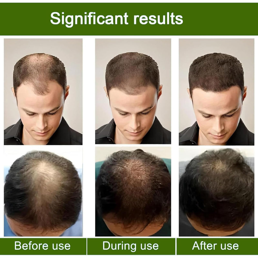AlphainFuze before-and-after style illustration suggesting thicker-looking hair