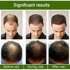 AlphainFuze before-and-after style illustration suggesting thicker-looking hair