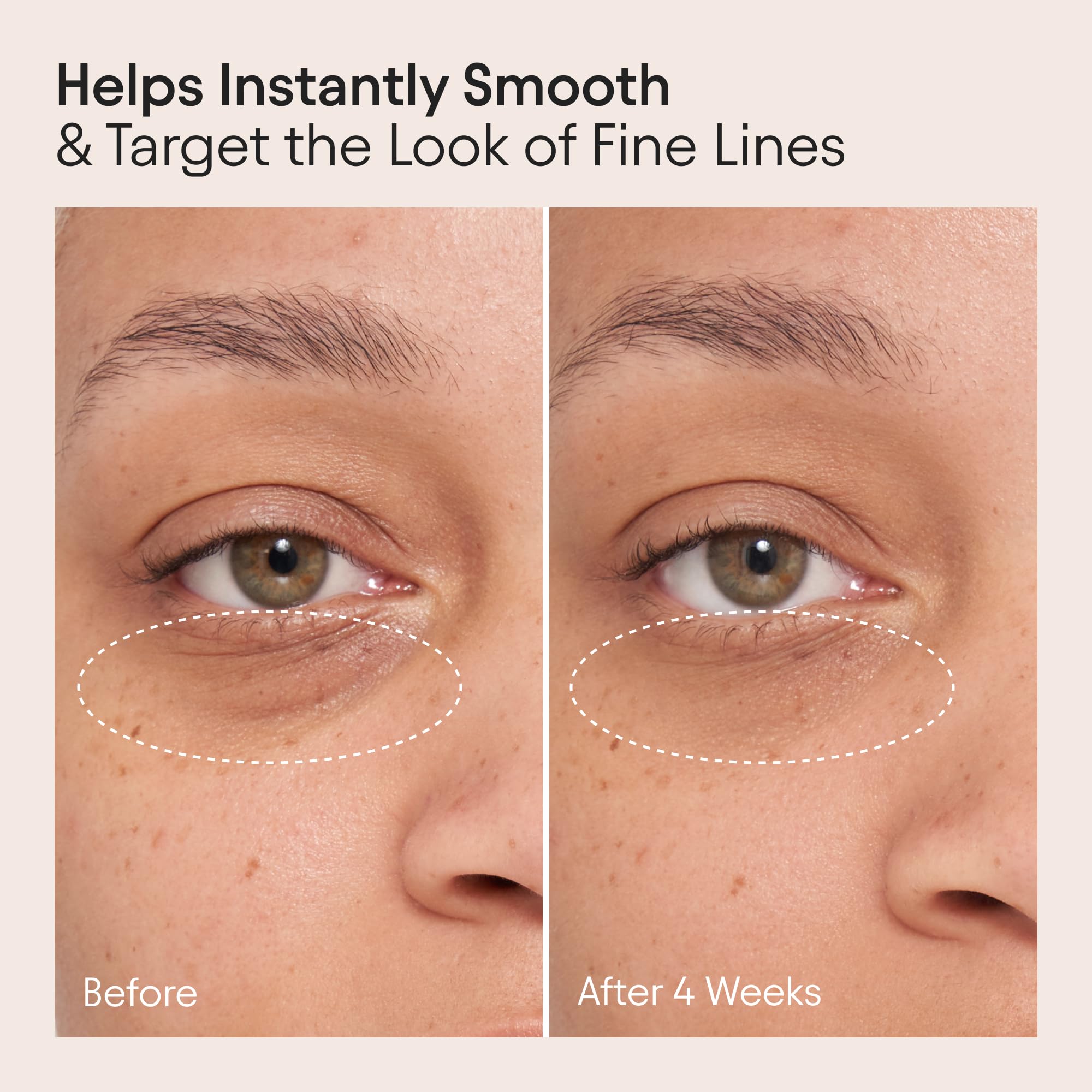 Uva Ursi and Vitamin C brighten the under-eye look