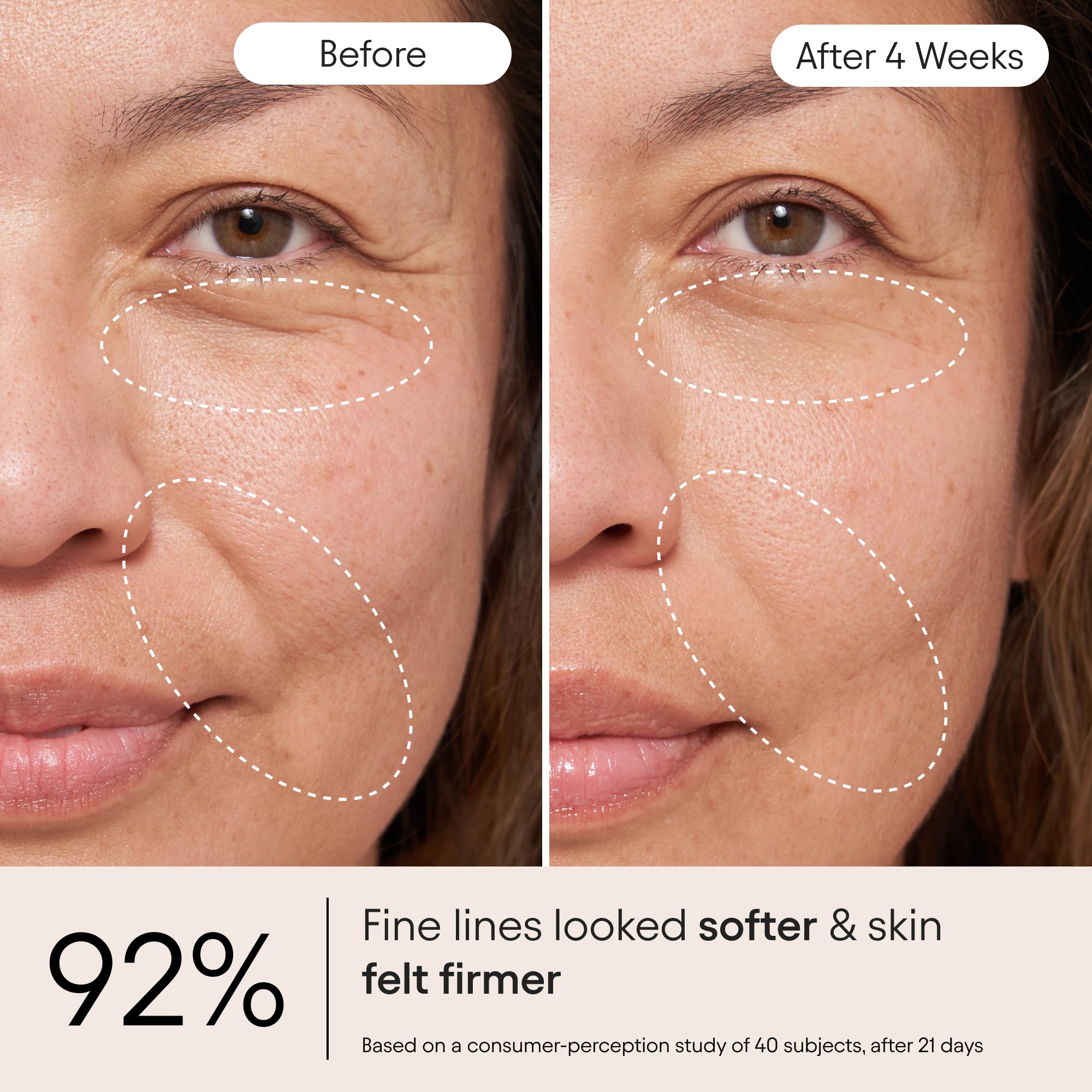Alpyn Beauty cream swirl on skin highlighting hydrating feel.