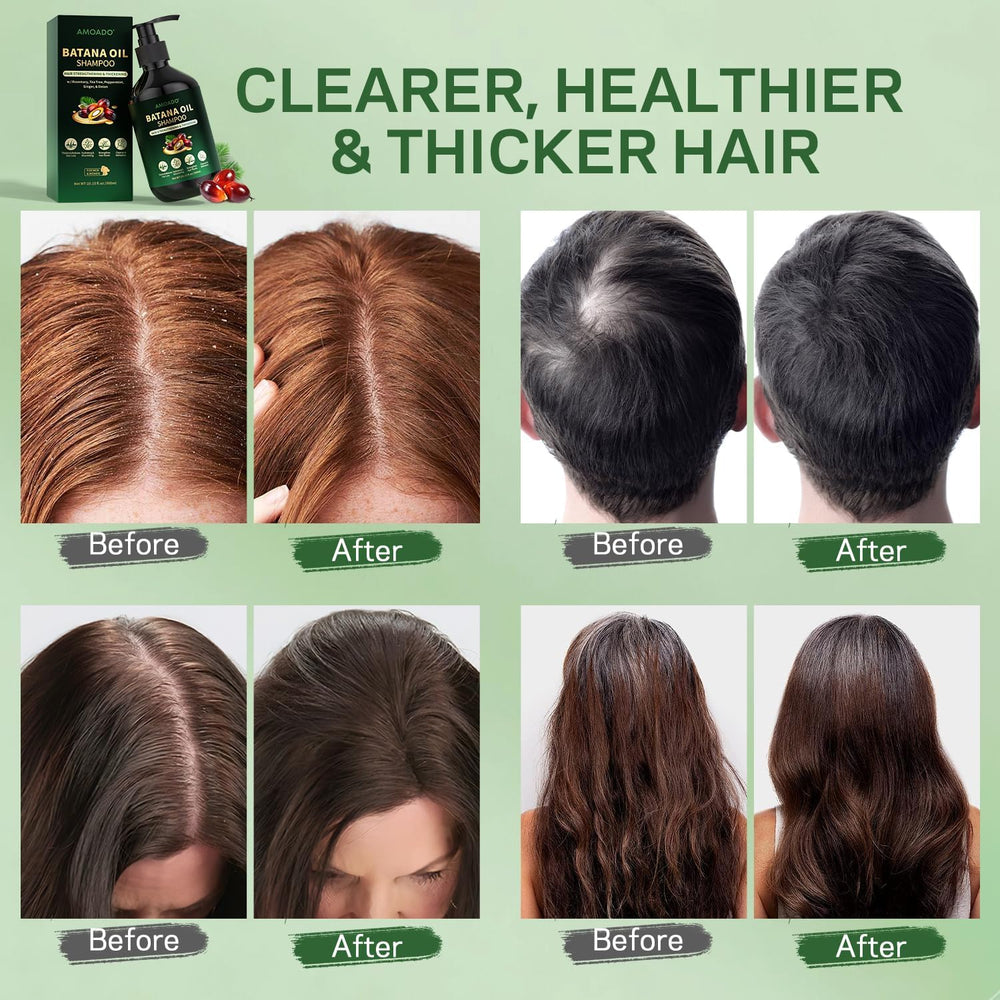 AMOADO hair-growth thickening effect suggests more body and bounce.