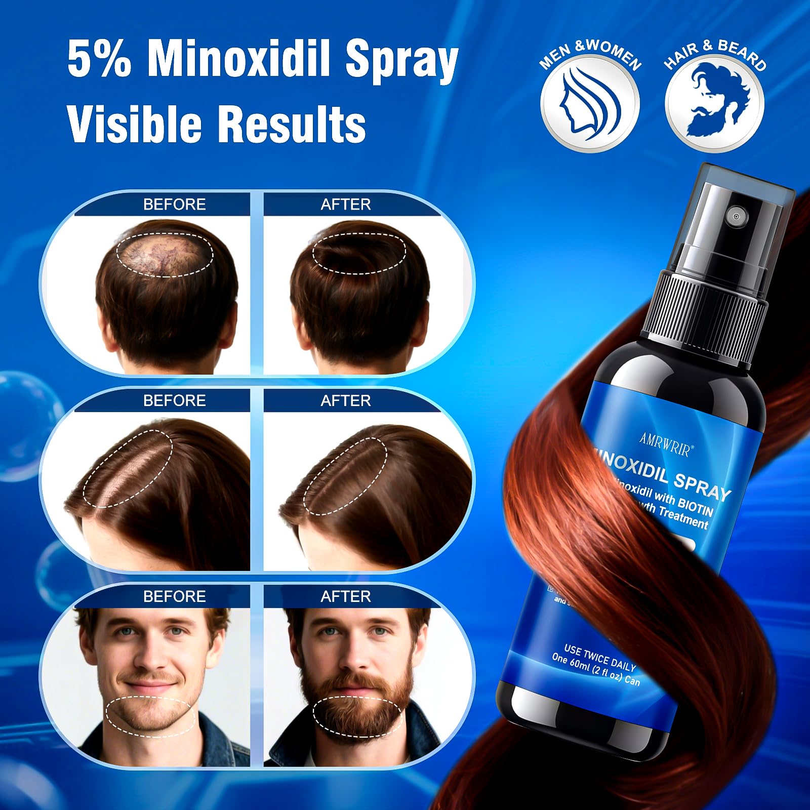 AMRWRIR Minoxidil spray being applied to the scalp for targeted thinning areas
