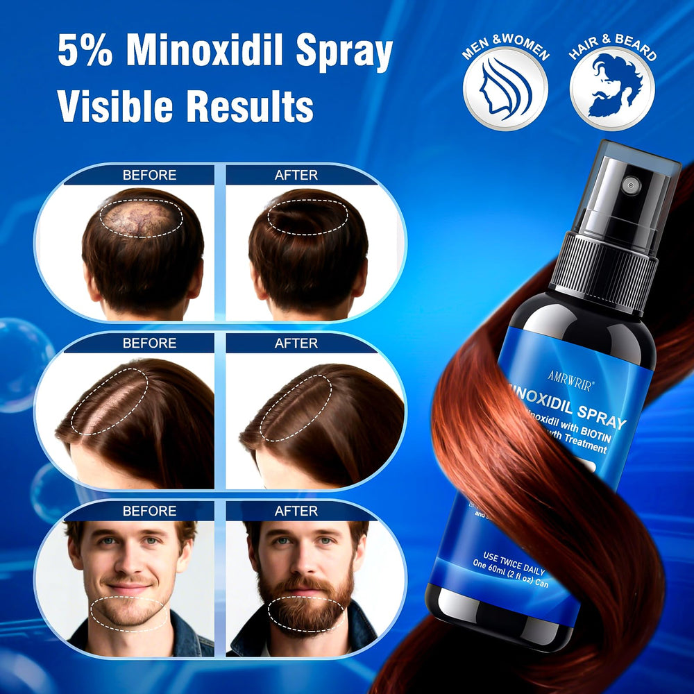 AMRWRIR Minoxidil spray being applied to the scalp for targeted thinning areas