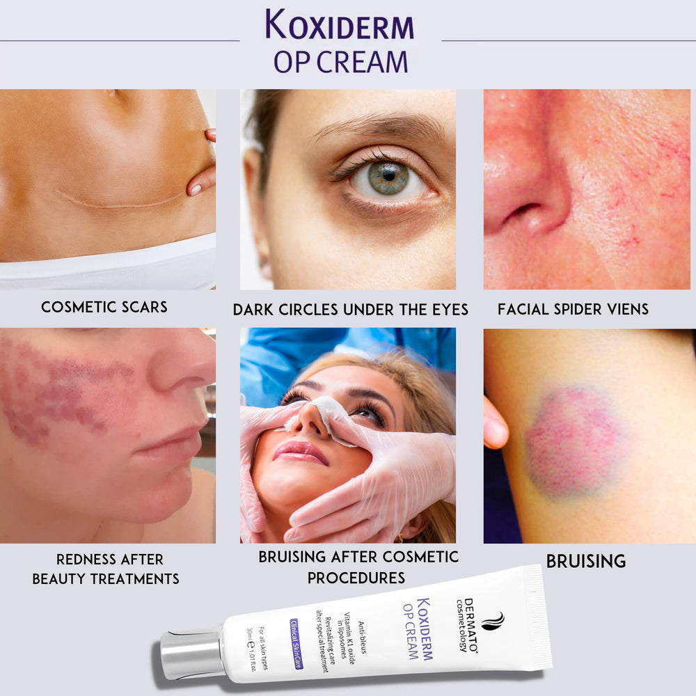 Anacis Vitamin K1 Oxiderm Cream focuses on under-eye area for a refreshed look.