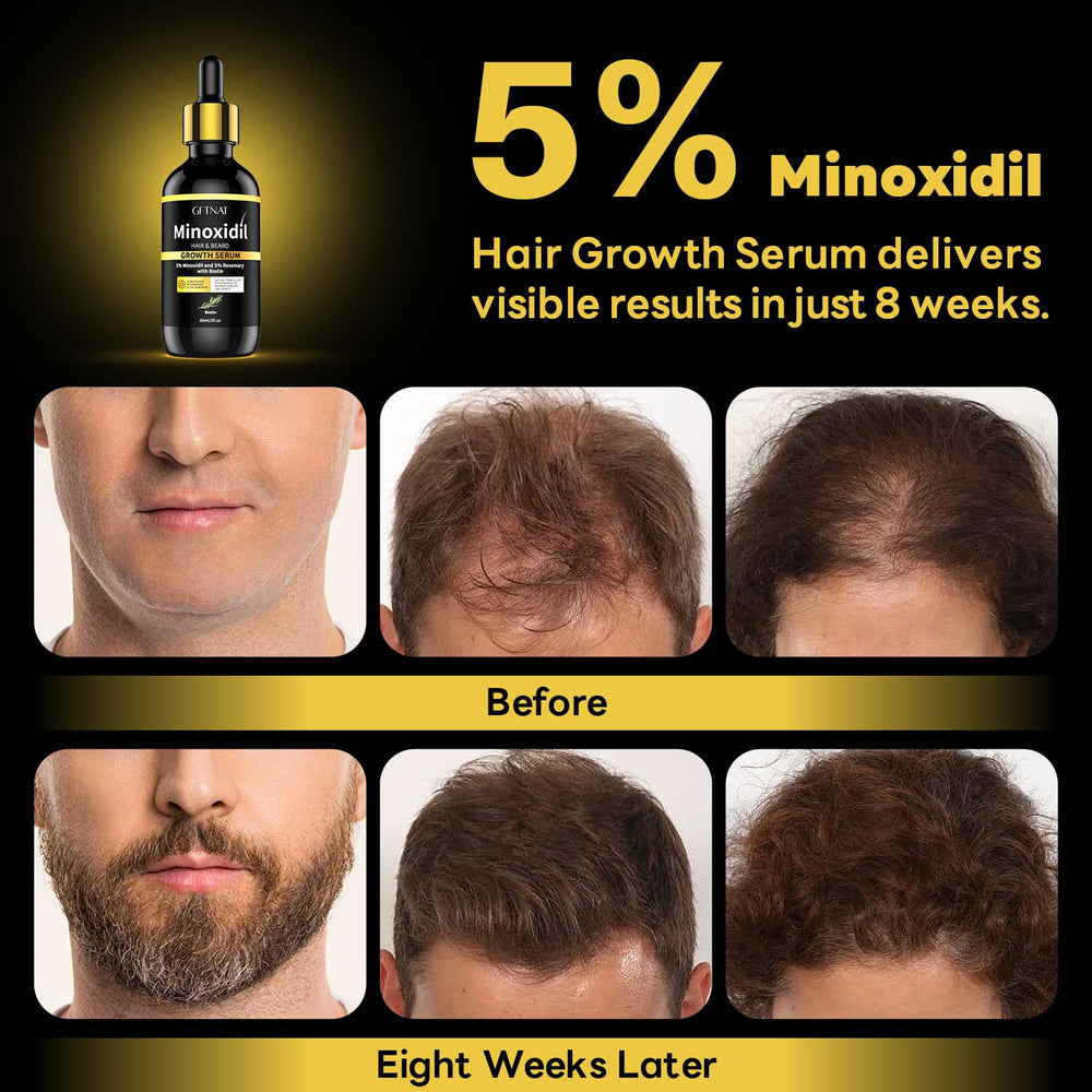 Andelusita minoxidil scalp serum drops illustrate targeted scalp care.