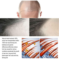 ANEFOSE Hair Regrowth System packaging box for home use