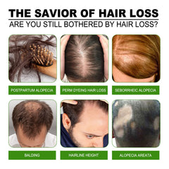 ANEFOSE Hair Regrowth System peppermint oil scent during routine