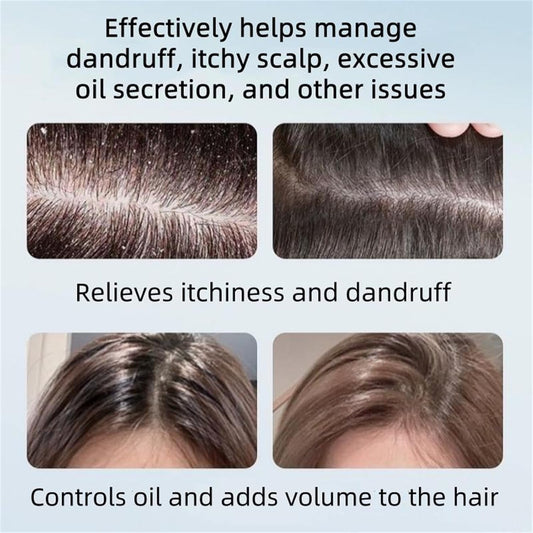 Anti-dandruff shampoo lather demonstrates gentle cleansing and refreshing feel.