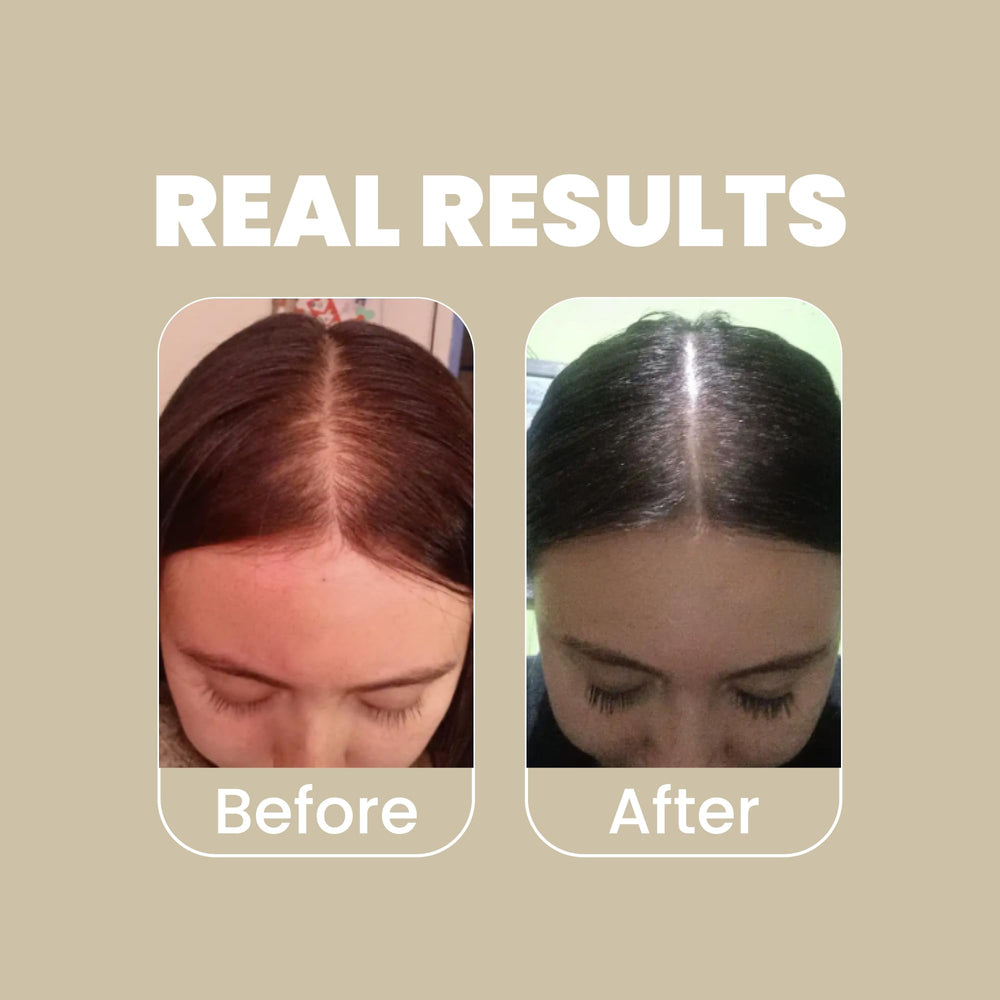 ANYELUZ onion extract focus suggests scalp revitalization and body.