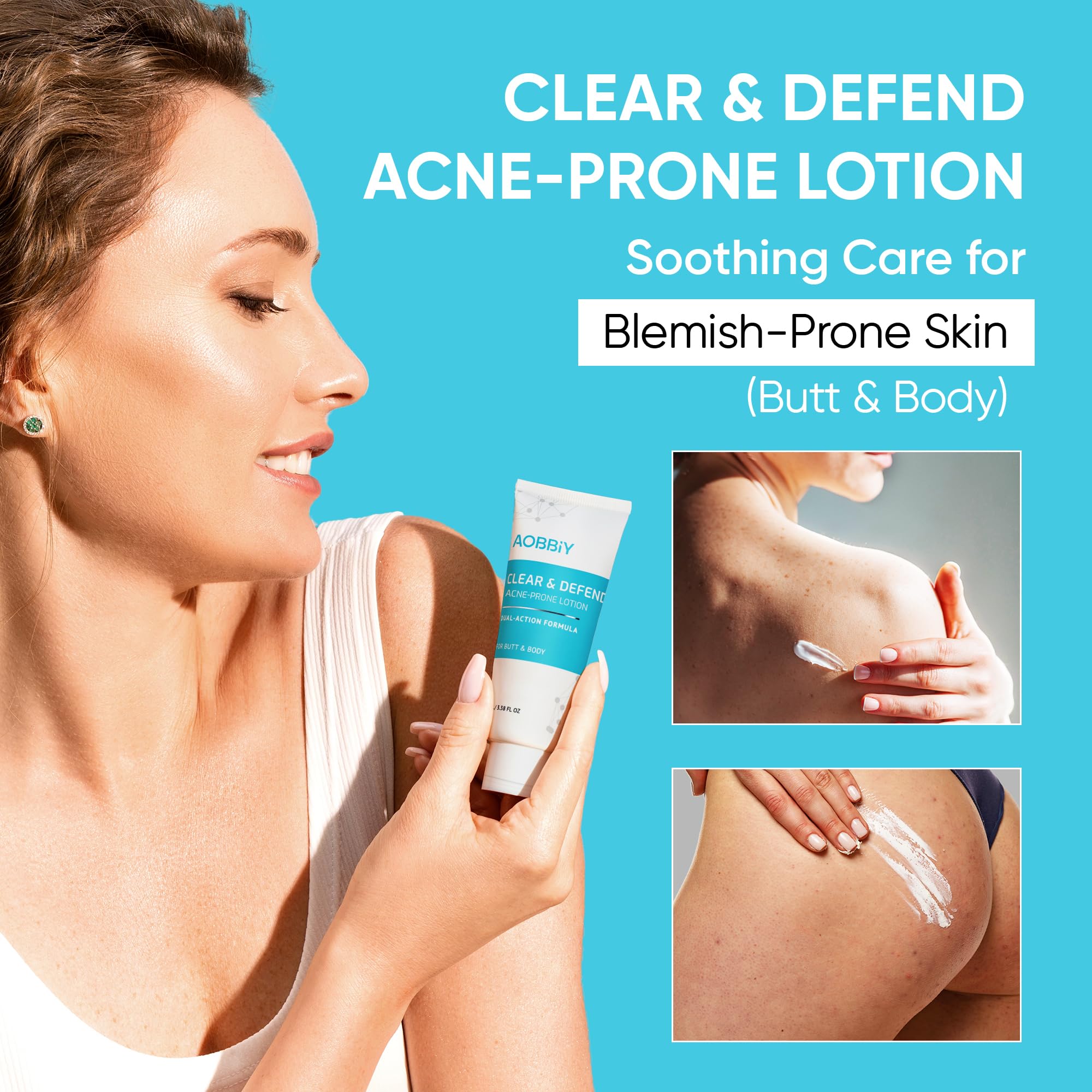 Aobbiy back acne lotion being applied for even coverage.