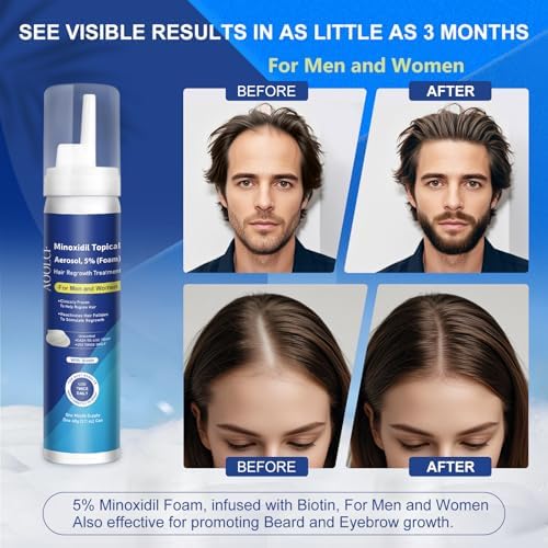 AOOLCF Biotin-infused Minoxidil Foam with added nutrients for hair health