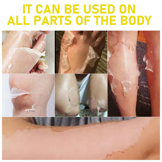 AOPEIBOTO peeling oil being applied with cotton swab for precise spot treatment