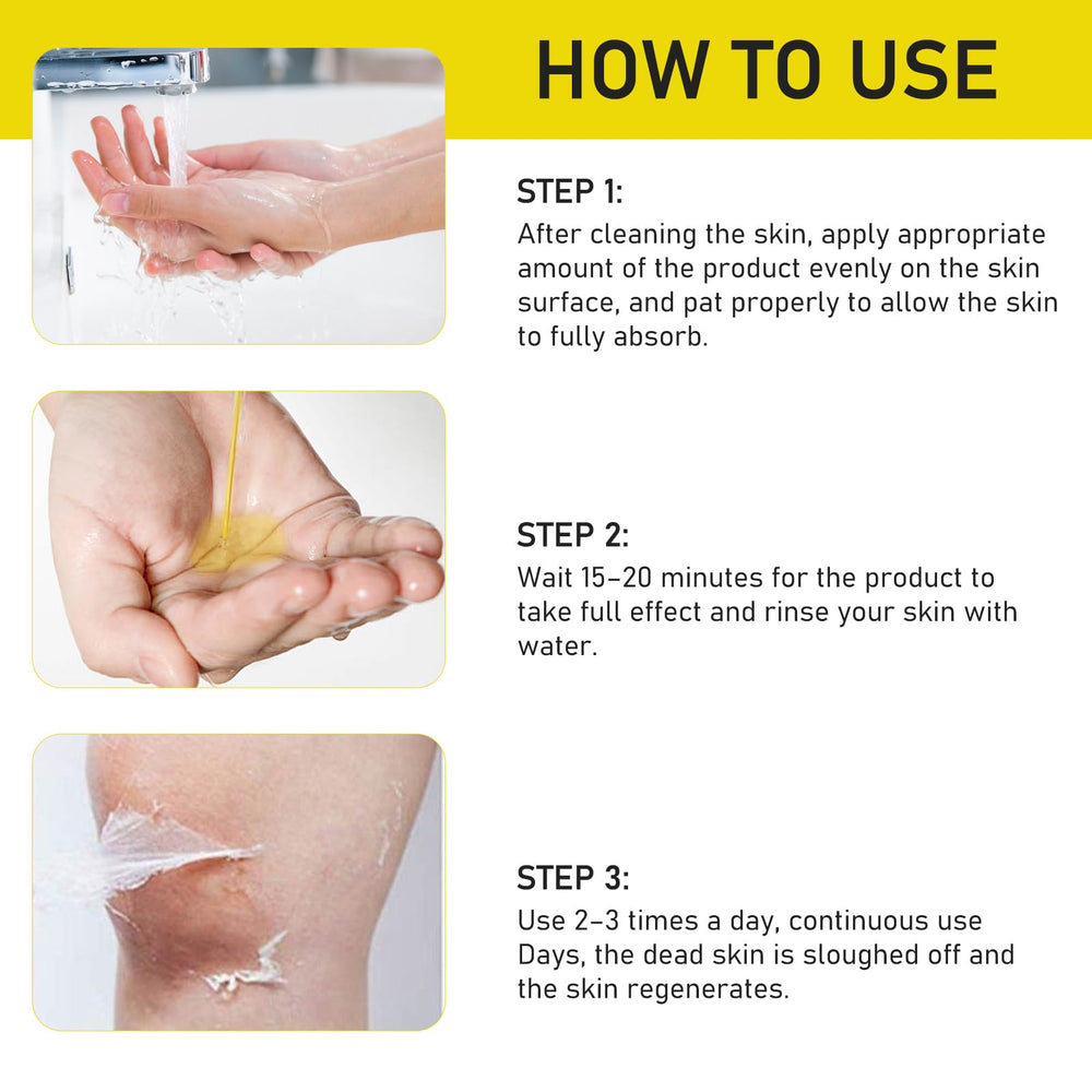 AOPEIBOTO Yellow Peeling Oil on feet for leg exfoliation