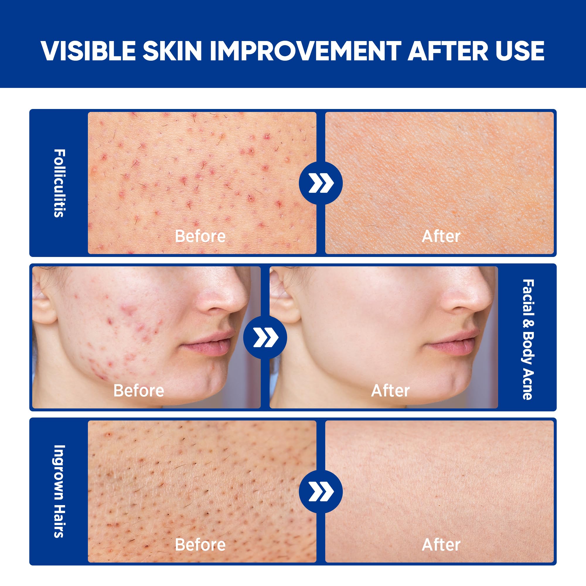 AOSORW body application image suggests versatile coverage for skin regions.