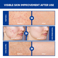 AOSORW body application image suggests versatile coverage for skin regions.