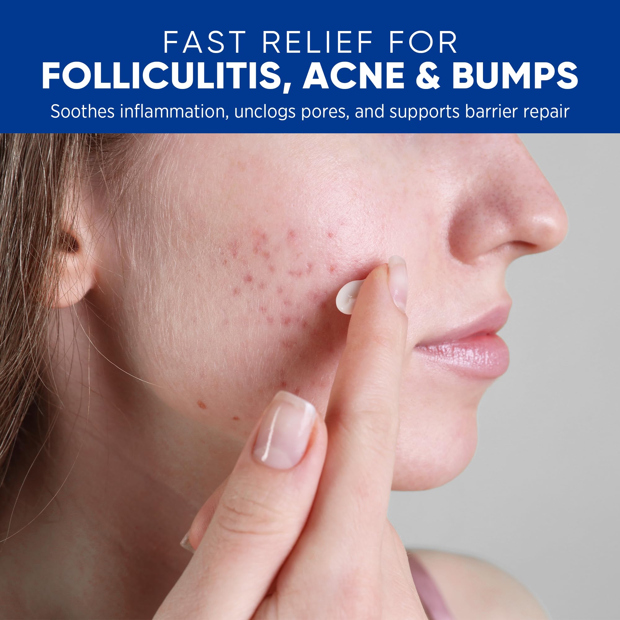 AOSORW Folliculitis Cream texture close-up showing non-greasy absorption.
