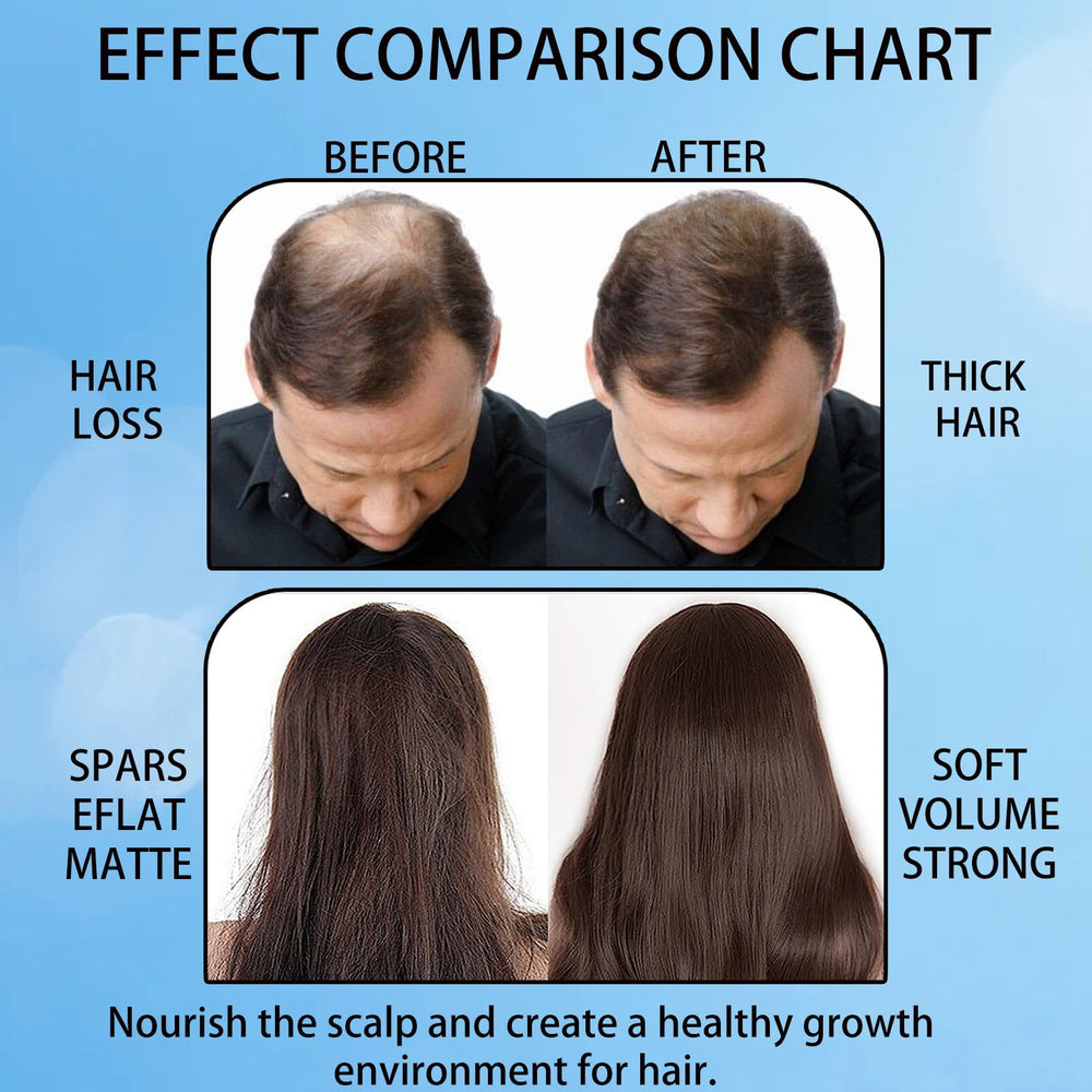 Aparthy salicylic acid exfoliates scalp gently for improved texture.