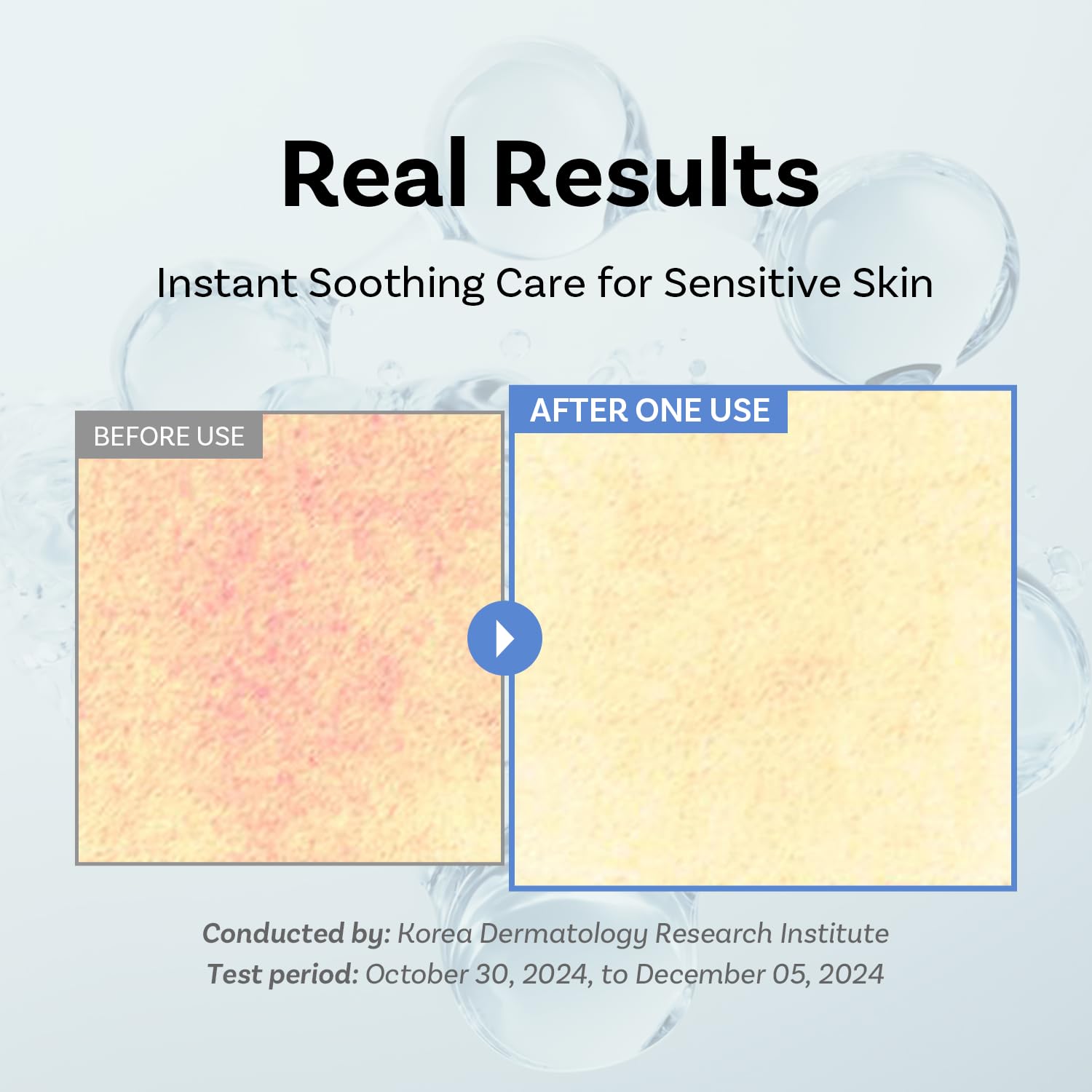 APOTHE Exosome Squal-Tox cream swirl on skin for instant moisture