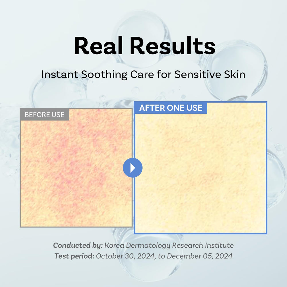 APOTHE Exosome Squal-Tox cream swirl on skin for instant moisture
