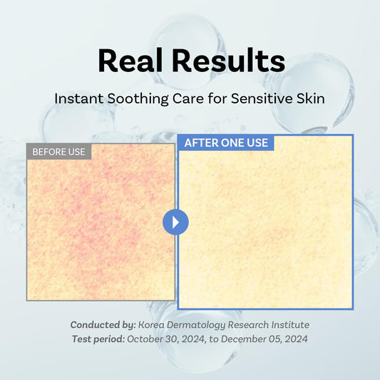 APOTHE Exosome Squal-Tox cream swirl on skin for instant moisture