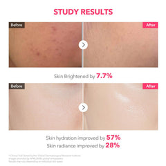 APRILSKIN TXA Pink Capsule Gel Mask non-sticky finish after absorption.