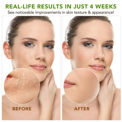 APUUFYQC Creamy texture on skin during application; feels soothing