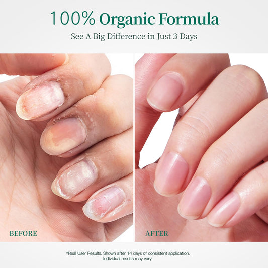 APUREE cuticle oil brush-application shown for easy, fast-absorbing massage.