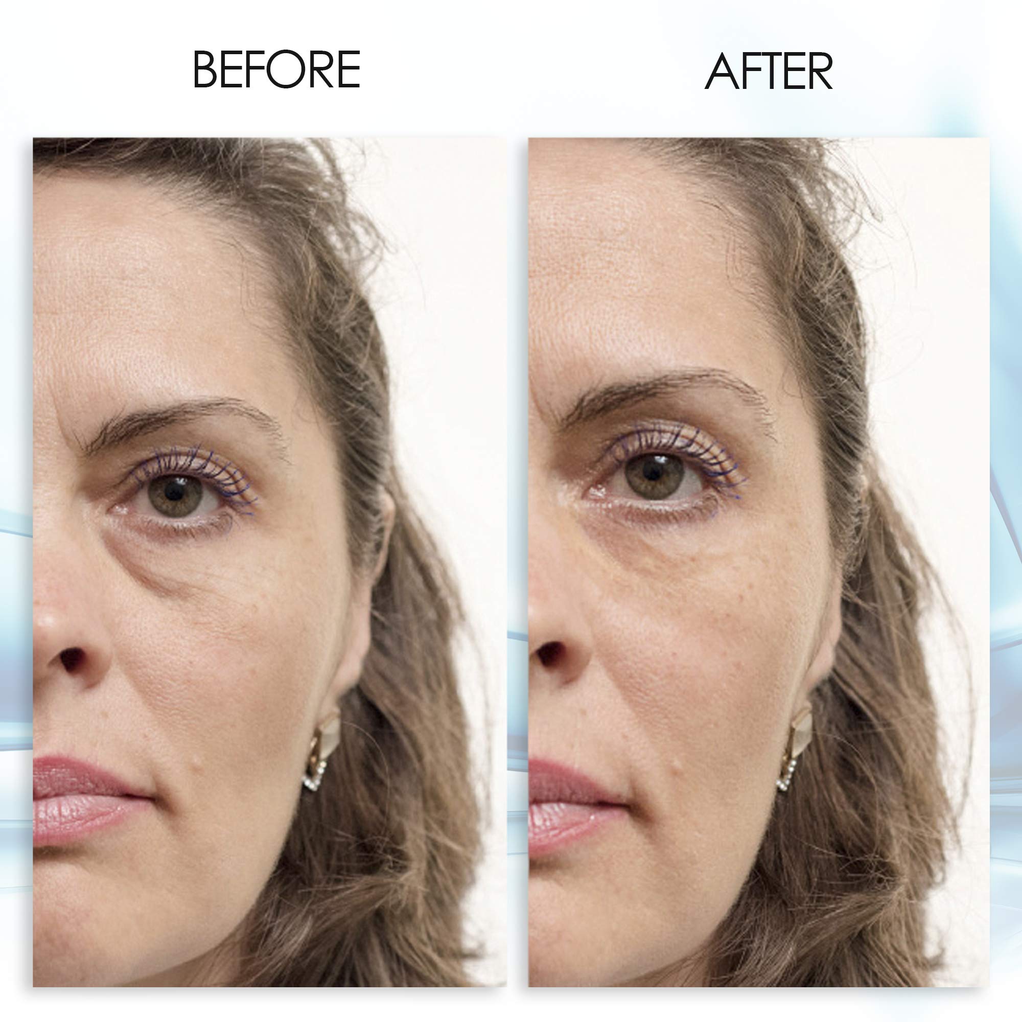 Aqua Mineral Eyeliss Complex graphic highlighting puffiness reduction.