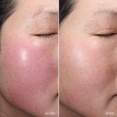 Lifestyle shot of a spa-like ritual with Aramore NAD+ Cream