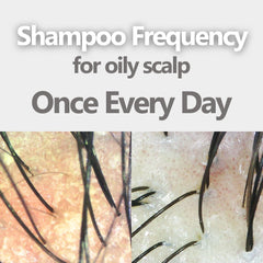 AROMASE 1% glycyrrhetinic acid complex supports calmer scalp with reduced redness