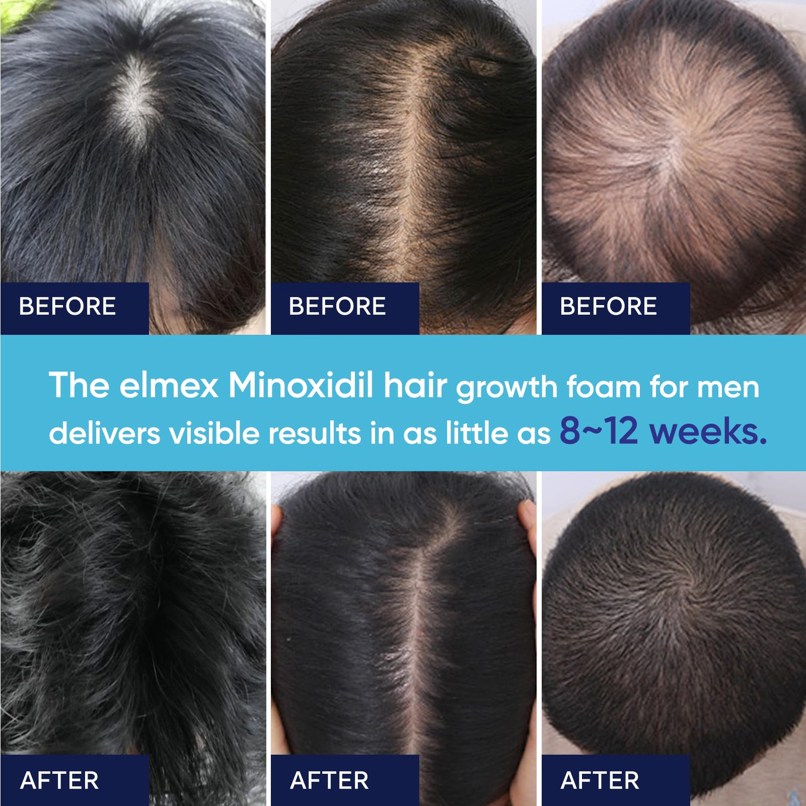 Artimore foam is suitable for both men and women in daily routines.