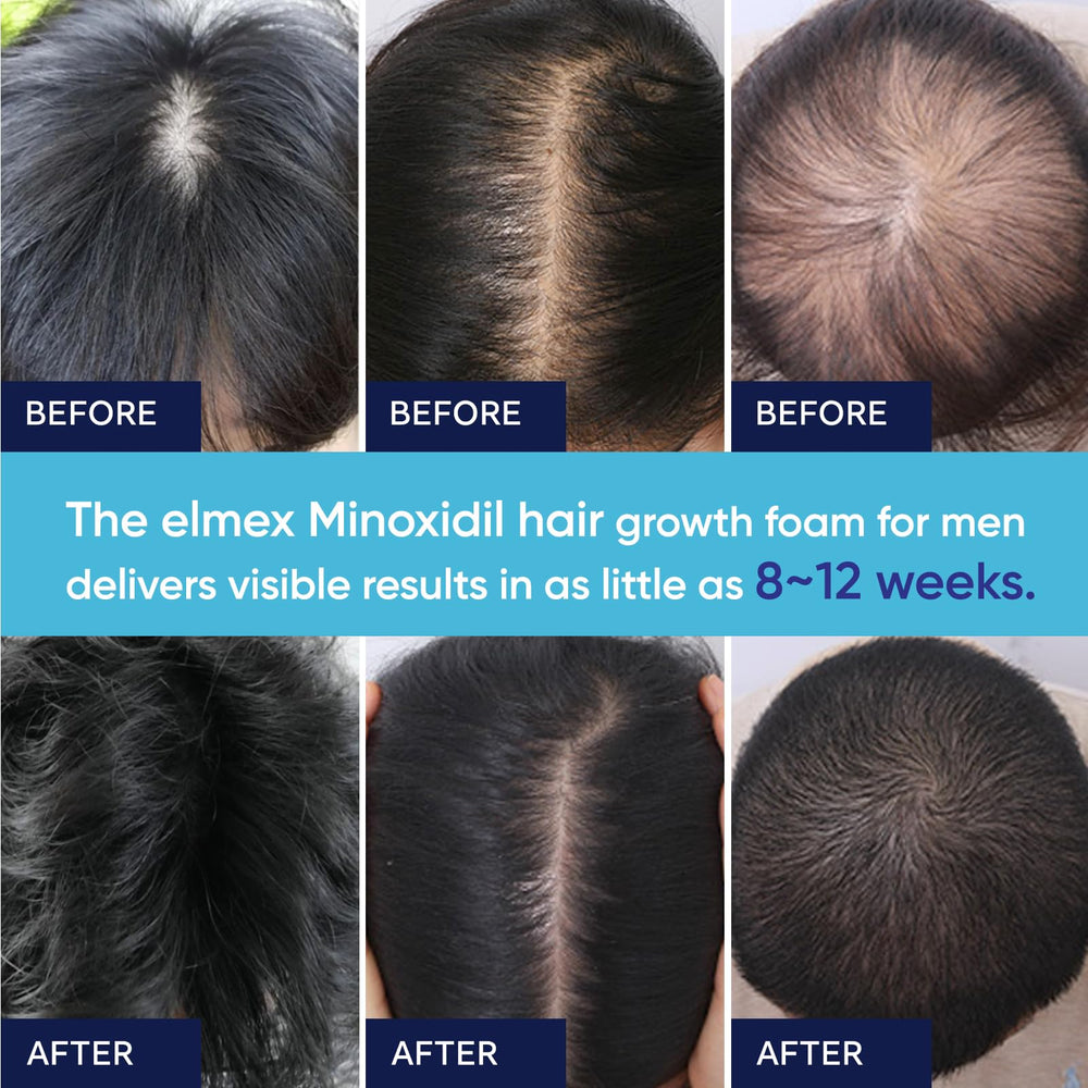 Artimore foam is suitable for both men and women in daily routines.