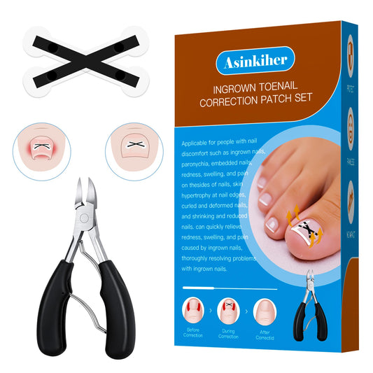 Asinkiher ingrown toenail treatment kit with X-Type corrector for precise toe care.