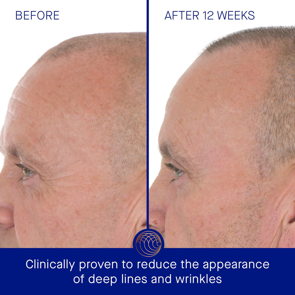 Serum being applied, illustrating quick hydration and renewal with Augustinus Bader.