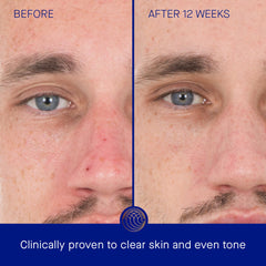 Creamy texture swirl of Augustinus Bader Retinol Serum for smoother skin appearance.